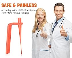 Painless Safe Skin Tag Remover Device Kit Micro