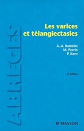 Les  varices et télangiectasies