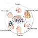 Toe Separators - Toe Straightener for Plantar Fasciitis and Bunion Corrector. Blue Toe Spacers. Free Heel Cups. (6 pcs)