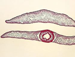 Planaria w.m., Classpack of 15 Slides