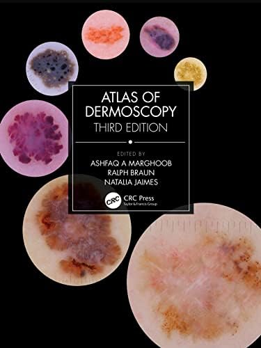 Histopathology of the skin: Walter F. Lever: 9780397520954: Amazon