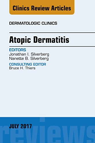 Atopic Dermatitis, An Issue of Dermatologic Clinics, E-Book (The Clinics: Dermatology) - //medicalbooks.filipinodoctors.org