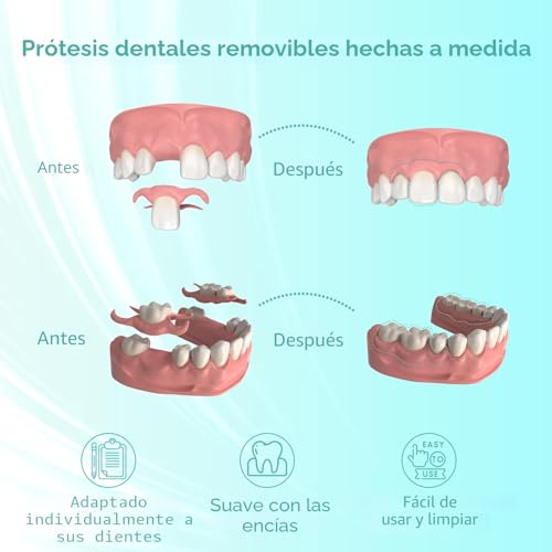 Custom Partial Denture for Dental Spaces - Removable Provisional Denture for Men & Women, Dentures with Perfect Fit Easy to Use for a Perfect Smile (2 Teeth)
