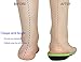 Orthotics Insoles Arch Support Inserts (2 Pairs) Comfort Sports Insoles Plus Support Anti-Fatigue Technology Replacement Insole Athletics Leisure and Workthumb 3