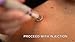 Iceshot Pre Injection Skin Numbing Pain Relief Device, 2 Ounce
