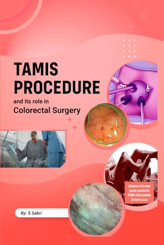 TAMIS PROCEDURE and its role in COLORECTAL SURGERY