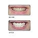 Go Smile Double Action Whitening System- 24 Count