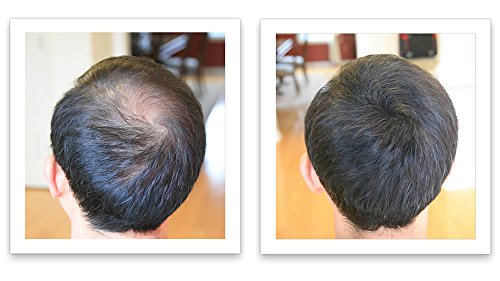 Caboki Hair Loss Concealer (All-Natural Hair Building Fibers) Travel Size (Dark Brown)