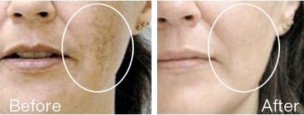 Ultra White Purifying Skin Brightening Lotion 475ml - lightening bleaching fairness whitening - helps with discoloration