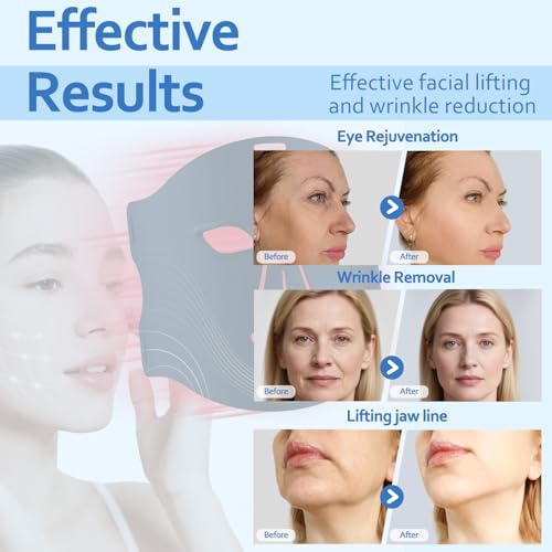 Medical-Grade LED Facial Mask, 7-Color Photon Therapy for Wrinkles & Collagen Boost, FDA-Cleared Anti-Aging Device for Face, Pain-Free Skin Rejuvenation for All Skin Types, Rechargeable & Comfortable