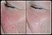 Best Mud Mask - Aloe Base Removes Blackheads, Reduces Wrinkles, Relief from Acne, Pimple and Shrinks Pores Instantly Guaranteed - No Burning or Irritation Unlike Other Masks.