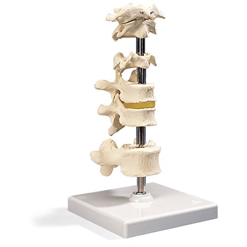 3B Scientific A75 6 Mounted Vertebrae Model, 8.7