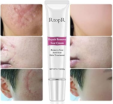 rtopr repair remove scar cream