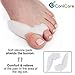 Orthopedic Bunion Corrector Splint and Protector Sleeves Kit - Hallux Valgus Pain Relief, Big Toe Joint, Hammer Toe, Gel Toe Separator Spacer and Straightener Splint Correction Aid, for Women and Men