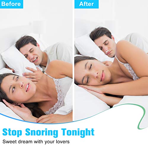image for QUIETIMER 2-in-1 Anti Snoring Devices, Snoring Solution Nasal Dilator 