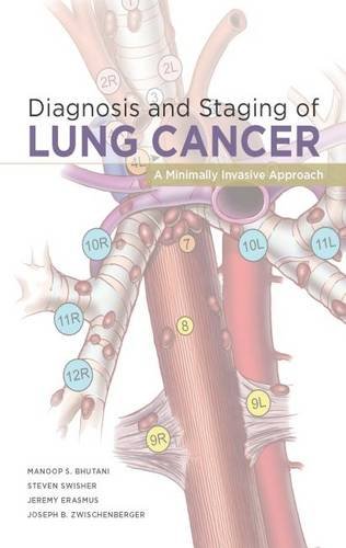 DIAGNOSIS AND STAGING OF LUNG CANCER: A MINIMALLY INVASIVE APPROACH