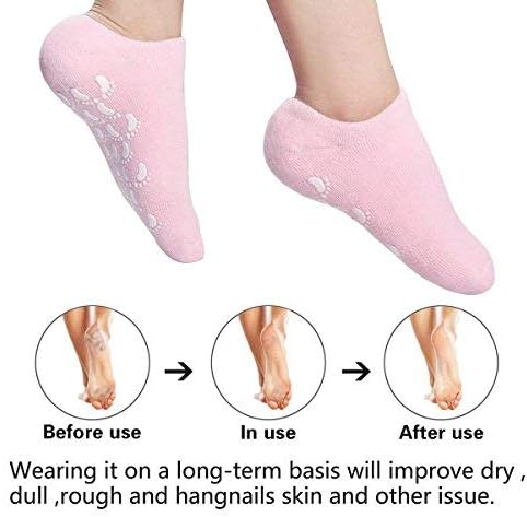 Hkc House Gel Spa Silicone Foot Care Gloves (Pink) - 1 Pair
