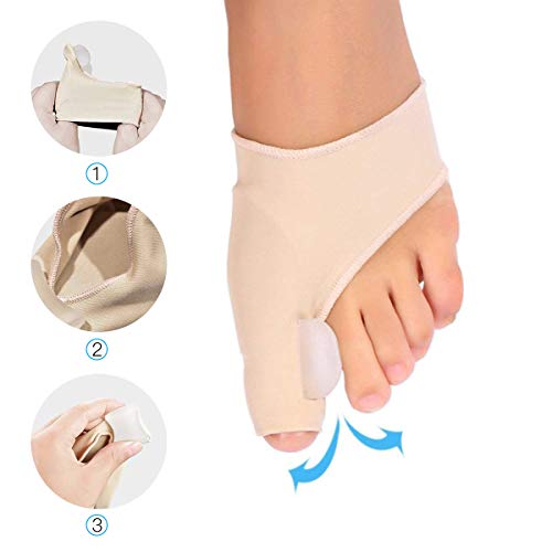 Bunion Corrector and Bunion Care Kit for Tailors Bunion, Hallux Valgus