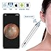 WiFi Ear Endoscope, TSAAGAN Built in WiFi Wireless Ear Otoscope Inspection Camera Earwax Cleaning Ear Pick Spoon Tool with 6 Led Lights Borescope for iPhone, Android Smartphone, iPad