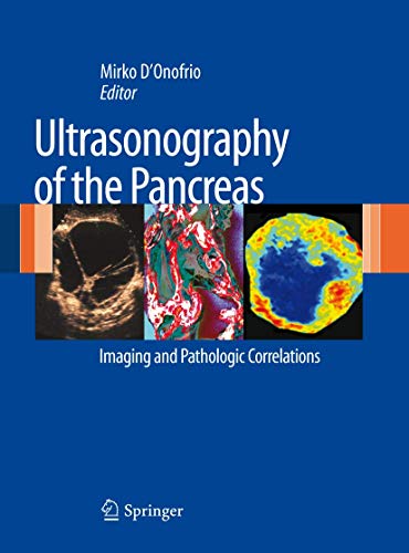 Ultrasonography of the Pancreas: Imaging and Pathologic Correlations at Amazon