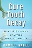 Cure Tooth Decay: Heal And Prevent Cavities With Nutrition - Limit And Avoid Dental Surgery and Fluoride by Ramiel Nagel New: $9.99 Auto-delivered wirelessly to Kindle. Cosmetic Dental Surgery