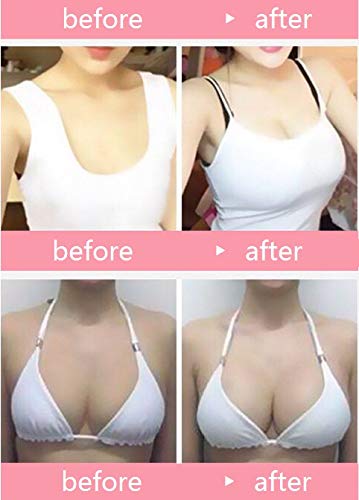 Electric Breast Enhancement Enlargement Massagers Liposuction Vacuum Cup Massage Tools, Chest Gain Cupping with AB C 2 Cups for Women AnyBack
