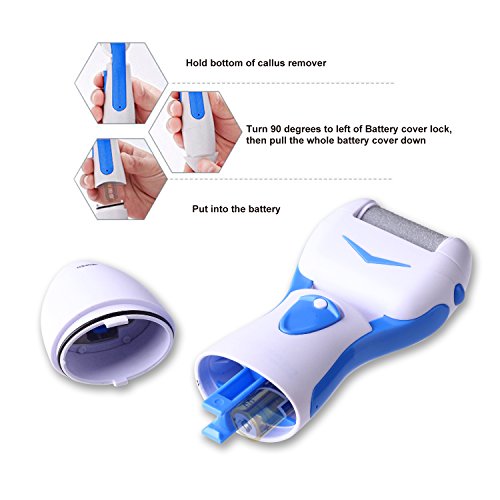 Electronic Callus Remover,IMSTM [Two Rollers More Effective] Pedicure
