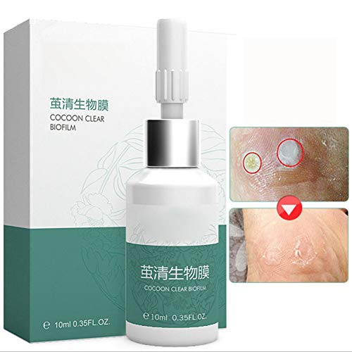 Corn Remover, Callus and Corn Remover Liquid, Foot Hand Care