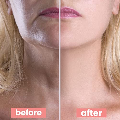 Muzooy Upgrade Chest Wrinkle Pads , Anti Wrinkle Silicone Chest & Neck Patches, Resuable and 100% Medical Grade Décolleté Anti Wrinkle Patches, Overnight Wrinkle Remover Treatment while Sleeping