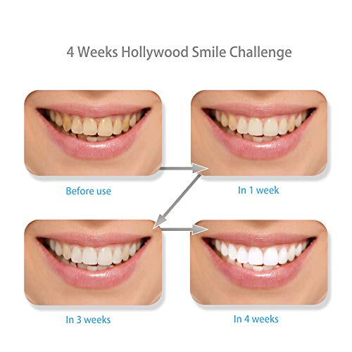 Teeth Whitening Strips, Professional Whitening Strips Kit with 3D Non-Slip Dental Teeth Whitener, Removes Stains & Freshens Breath with Coconut Oil, 14 Sets, 28 White Strips - Thumbnail 3