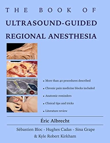 Amazon.com: Hadzic's Textbook of Regional Anesthesia and Acute