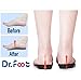 Dr. Foot's 3/4 Length Orthotics Insoles - Best Insoles for Corrects Over-Pronation, Fallen Arches, Fat Feet - Plantar Fasciitis, Heel Spurs and Other Foot Conditions -1 pair(L - W11-12.5 | M9.5-11)