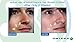 Omiera Anti Wrinkle Cream, Dark Spots Corrector, Acne Treatment, Hair Inhibitor, Dark Circles Under Eyes Treatment, Hair Growth Inhibitor, Eyelash Growth Serum Anti-Aging Skin Care Set