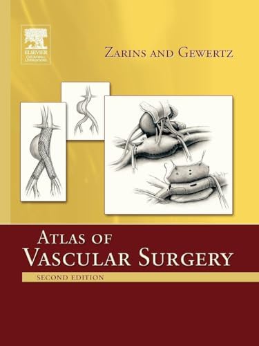 Hinman's Atlas of Urologic Surgery Revised Reprint: 8600007167991