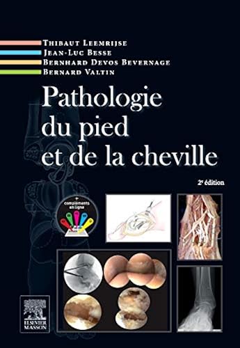 Download Pathologie du pied et de la cheville PDF