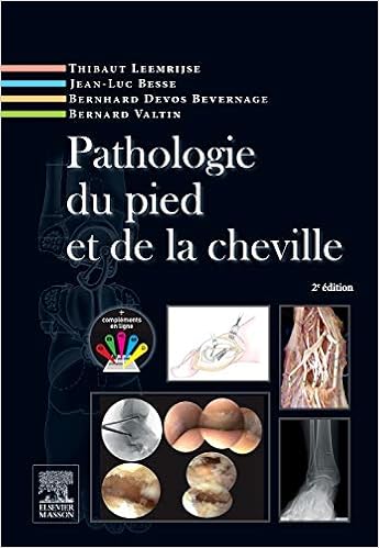 Pathologie Du Pied Et De La Cheville Thibaut Leemrijse - 