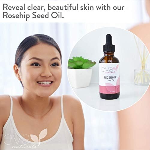 eva naturals for acne