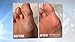 Personal Pedi Rechargeable Foot Callus Remover, Laurant