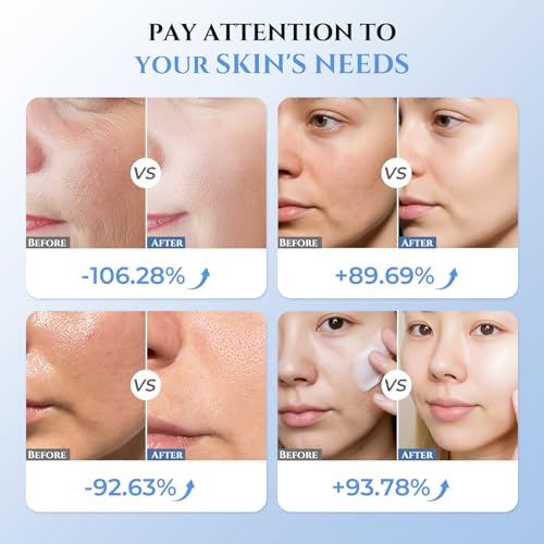 5-in-1 Face Massager - Professional Skin Care Beauty Devices with 5 Modes Function for Face, Neck, and Eye Area