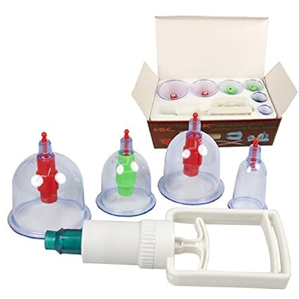 Massage Schröpfen Set mit 6 Schröpfgläser aus Kunststoff mit Vakuumpumpe