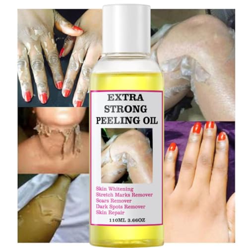 LBOYLOVE® 2 Pcs Yellow Peeling Oil, Extra Strong Peel Oil for Dark Skin with Camellia Leaf, Licorice Root and Chamomile Extract for Body Hand Foot, for All Skin Types