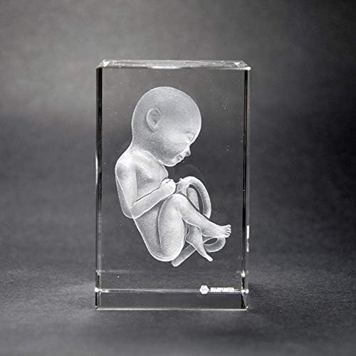 XIEJI 3D human Baby Fetus with Umbilical Cord Obstetric skeleton anatomical Crystal Model Skull condoms anatomy medical training(2.4x2.4x3.5 inch) 6 * 6 * 10 CM