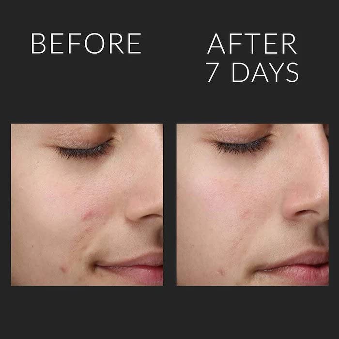 Kate Somerville Liquid ExfoliKate Triple Acid Resurfacing Treatment