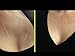 Bravity Women Anti-Wrinkle Cleavage Sleep Bra/Seamless & Adjustable Beige Size Large