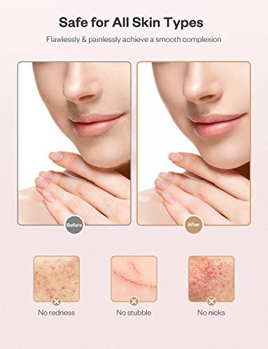 Facial Hair Removal for Women, Anjou Battery Operated Portable Hair Remover, IPX 6 Waterproof, Hair Trimmer for Fingers, Cheeks, Chin, Upper Lip, Arms