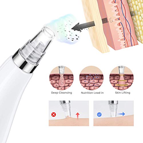 Blackhead Remover Vacuum Portable Blackhead Suction Tool with LED Display Facial Pore Cleanser Electric Acne Comedone Extractor Kit Women Christmas Gift (White)