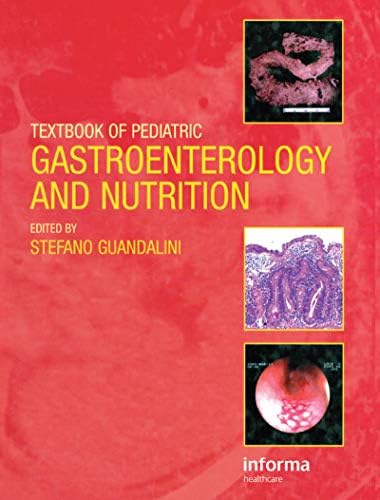 Nutritional Epidemiology: 9780195122978: Medicine & Health Science