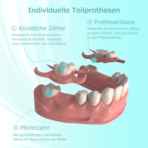 Custom Partial Dental Denture - Temporary Denture, Removable and Temporary Denture. Perfect fit and easy to use to recreate your smile at home (1 tooth)