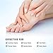 Wart Remover Plantar Wart Remover Foot Wart Remover Corn Callus Remover Wart Remover Liquid Common and Plantar Warts Treatment by NECOO (1PCS)thumb 3