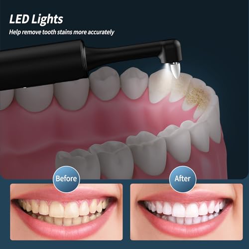 Tooth Polisher, Rechargeable Teeth Sander with 5 Brush Heads, 3 Polish Pastes, LED Light, 4 Speed Modes, Waterproof Dental Cleaning Kit for Whitening and Polishing (Black)